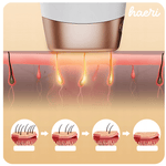 Illustration showing IPL laser epilator for hair removal process on skin, with before and after effects.