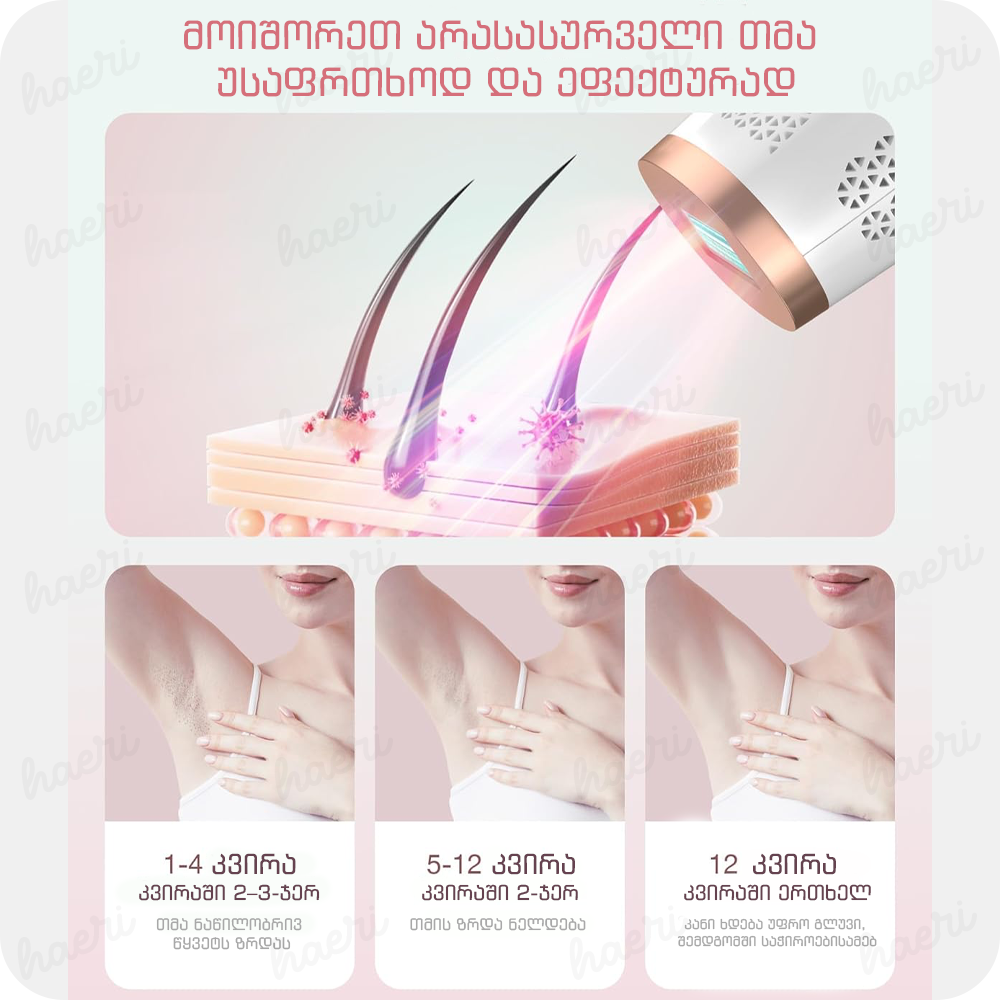 IPL ფოტოეპილატორიBHRL-04B